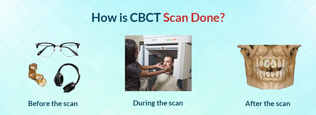 How is CBCT Scan Done